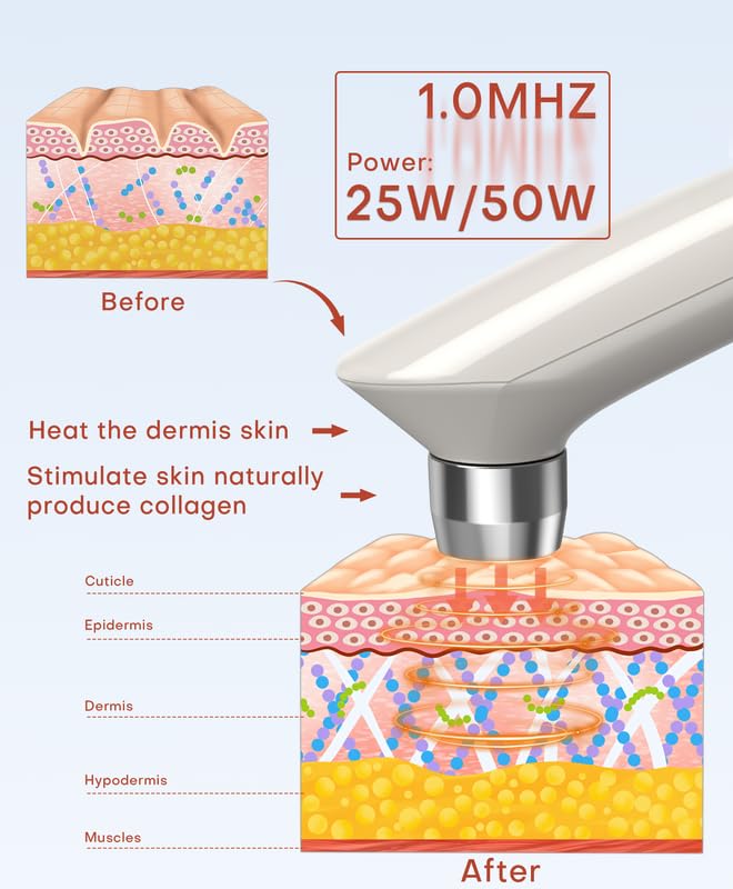 MLAY Professional RF Beauty Machine, Radio Frequency Face Machine with 2 Probes, at Home Radio Frequency Skin Tightening for Lifting, Wrinkle Reducing, Anti Aging - Salon Effects(Gel Included)