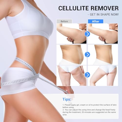 MEIQIER sens for Improvement in The Appearance of Cellulite Device Cellulite Massager Radio Frequency, White