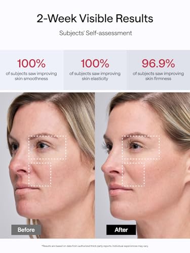 JMOON Face Lift Gift Collection, Microcurrent Facial Device, Medical Grade Red & Infrared Light Therapy for Face, Lifts, Firms, Smooths Wrinkles with 4 Modes & 5 Intensity Levels