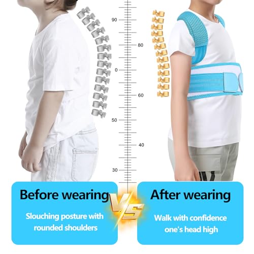 Posture Corrector for Kids,Adjustable Children Posture Corrector for Boys/Girls,Breathable Back Support Belt with Spine Lumbar Shoulder Braces for Hunchback，Spine Corrector (Blue, Small)