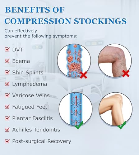 MGANG Medical 20-30 mmHg Compression Stockings for Women & Men, Pair, Thigh High Graduated Compression Socks, Closed Toe, Opaque, Support for Varicose Veins, Edema, DVT, Swelling, Flight, Beige 3XL