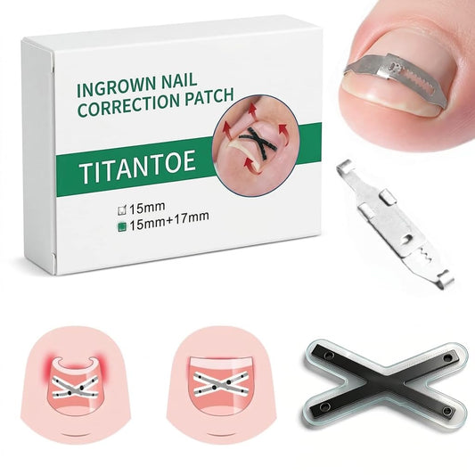 CHGRNLF Ingrown Toenail Treatment Kit, Titanium Alloy Ingrown Toenail Corrector Strips for Big Toe, Toenail Curve Corrector & Straightener for Curled Nails, At-Home Ingrown Nail Pain Relief, 6Pcs