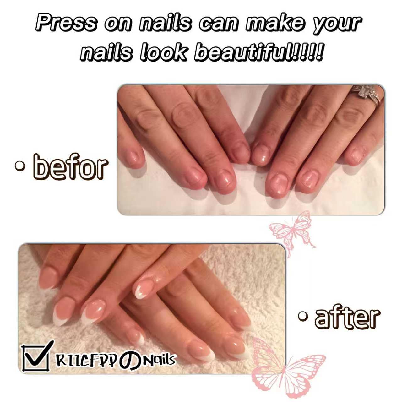 24 Pcs 3D Flower Press on Nails Medium Almond Fake Nails with Pearl Floral Designs Full Cover Glue on Nails Glitter Acrylic Blue and Yellow False Nail for Women