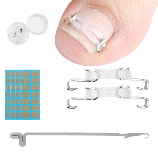 JIUDOUCUOIngrown Toenail correction Kit, Professional Nail Care Tools with Correction Clips and Adhesive Pads，Four correction clips can correct two toenails simultaneously