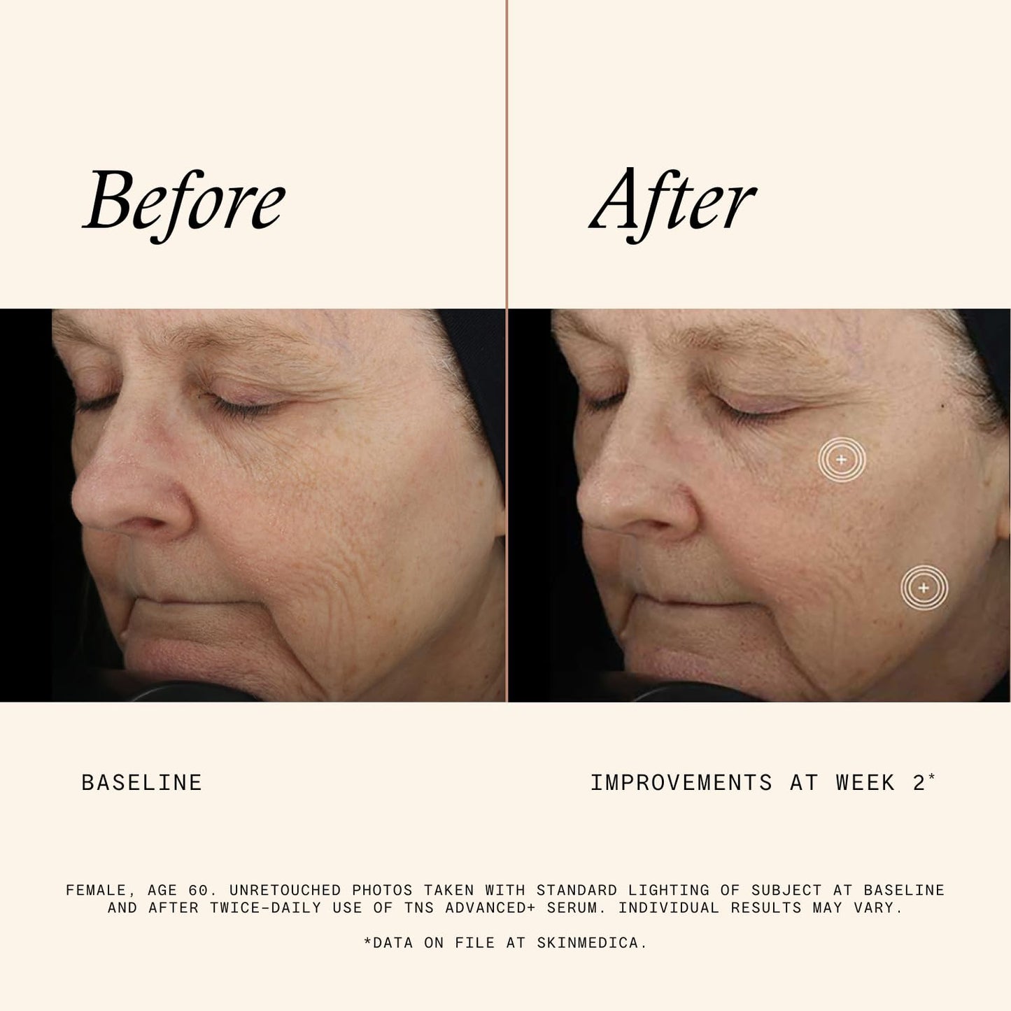 SkinMedica TNS Advanced+ Face Serum (NEW PACKAGING) - Multi Peptide Serum to Help Improve the Appearance of Wrinkles, Fine Lines, Skin Tone & Texture (1 Fl Oz)