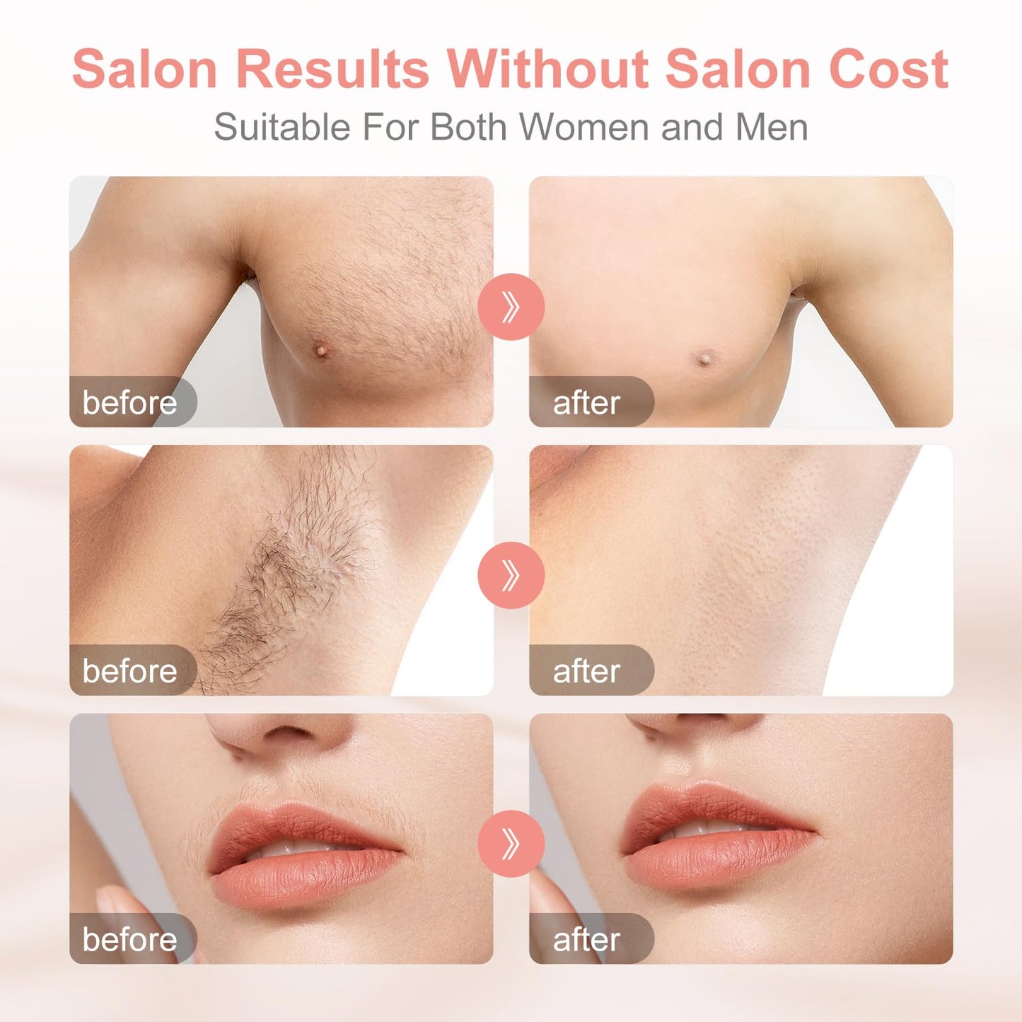 Aphrona® Hair Removal | For Full Body, Face, Sideburns, Stomach, Arms | Easy to Use |Safe & Effective Laser Hair Remover | Long-Lasting Hair Removal | FDA Cleared