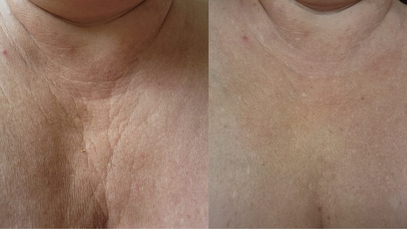 Hyaluronic Rejuvenating Serum for Face & Body 3.34 oz, Natural, Non-greasy, with Vitamin B5 and Niacinamide