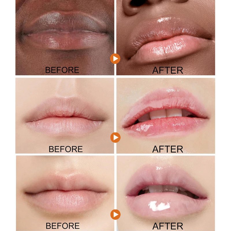 ARCHIDATE 2Pcs Turmeric Lip Balm for Dark Lips, Natural Turmeric Moisturizing Lip Balm for Smokers, Long-Lasting Moisturize Nourishes Softens Dry Chapped Dull Lips, Leaves Lips Looking Soft and Supple