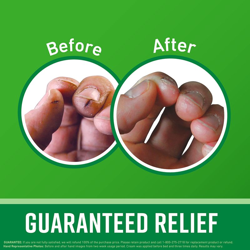 O'Keeffe's Working Hands Hand Cream, 6.8 oz Jar and Healthy Feet Foot Cream, 6.4 oz Jar - Repairing Skincare for Extremely Dry, Cracked Hands and Feet