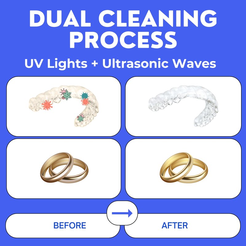 Hello Bright - Ultrasonic Retainer Cleaner, UV Cleaner for Invisalign, Night Guard, Mouth Guard, Jewelry - Retainer Cleaning Machine