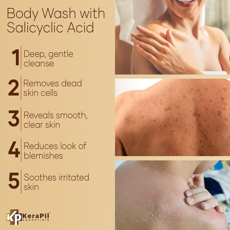 KERAPIL Exfoliating Body Wash with Salicylic Acid - No Dry Out, Gentle Exfoliates Rough and Bumpy Skin, Body Acne Wash, BHA & AHA - Coconut and Vanilla with Salicylic Acid - (16 fl oz)