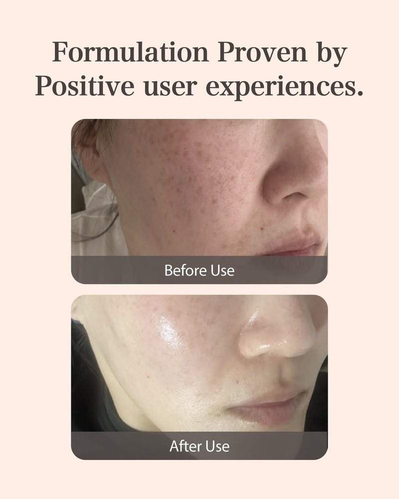 Mastina Mastic Ampoule - Facial Serum for Glass&Radiant Skin. White Mastic Complex 63% + Tranexamic Acid 2% + Niacinamide 5% Acid, Korean Skin Care (Dropper, 0.5fl oz)