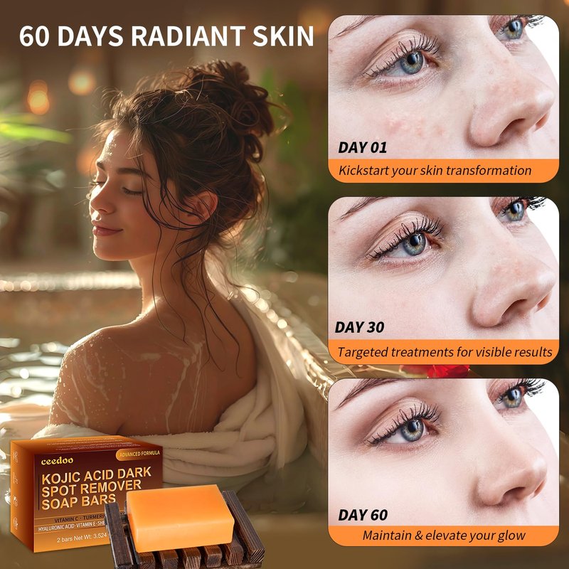 ceedoo Kojic Acid Soap for Dark Spot Remover Bars with Turmeric, Vitamin C, Retinol, Collagen with Hyaluronic Acid, Vitamin E, Shea Butter, Castile Olive Oil - 3.52 OZ x 2 Bars with Bag