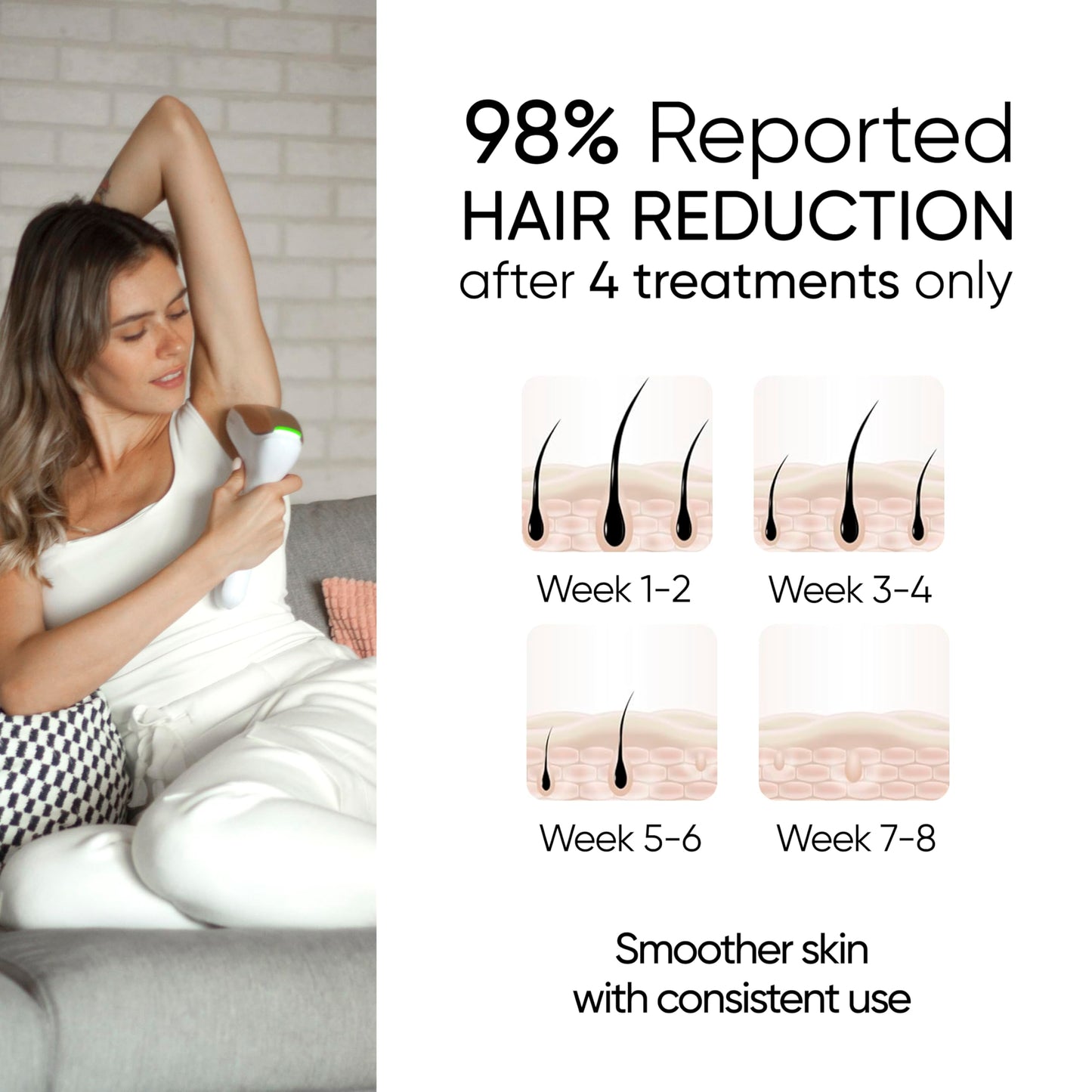 Sensica Sensilight PRO IPL Hair Removal Device – Powerful Cordless At-Home Hair Remover for Women & Men, 6 Energy Levels, 2 Treatment Windows, Patented RPL™ Advanced Technology, Full Body & Face