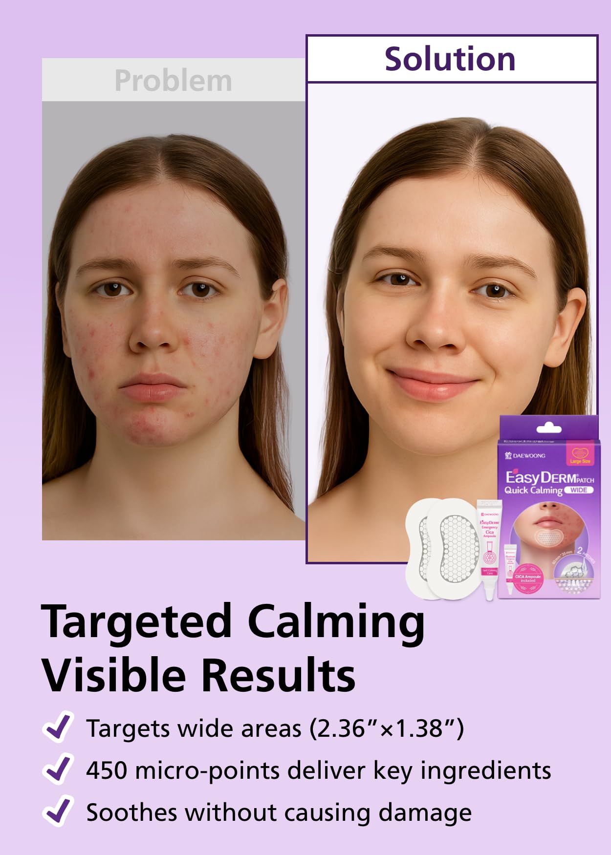 DWEasyDerm EasyDerm Quick Calming Magnesium Patches WIDE and Quick Calming Magnesium Patches, Summer & Travel Essentials