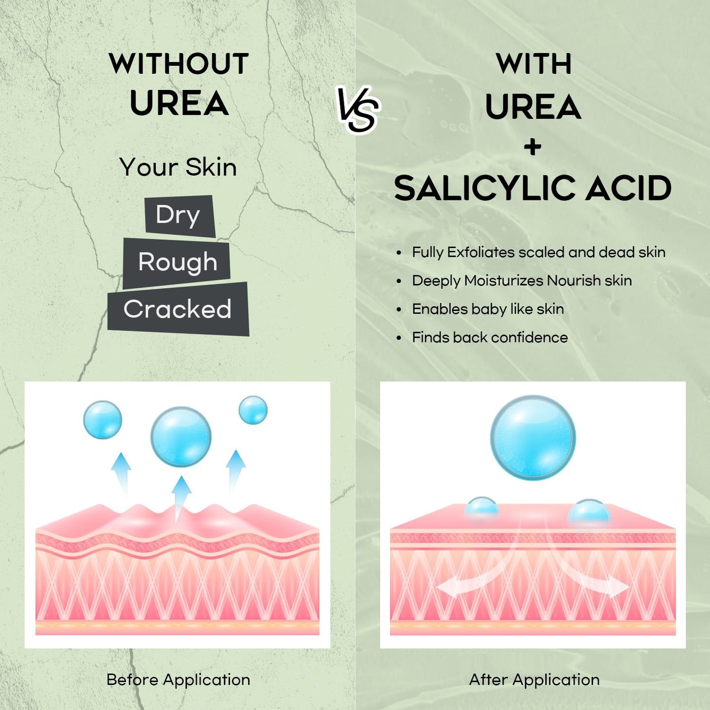 Vebuni Urea Cream 42% Foot Cream Salicylic Acid 4 Oz, Upgraded Callus Remover For Feet, Knees& Elbows, Intensive Moisturizes & Softens Skin, Exfoliates Dead Skin