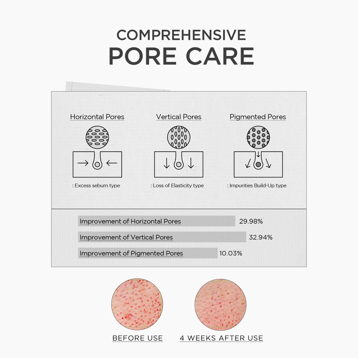 SKIN1004 Niacinamide 10% Boosting Shot Ampoule, Niacinamide Spicule Serum for Face, Facial Ampoule with Tranexamic Acid, Pore Minimizer for Face, Madagascar Centella, Korean Skin Care, 1.01fl.oz/ 30ml