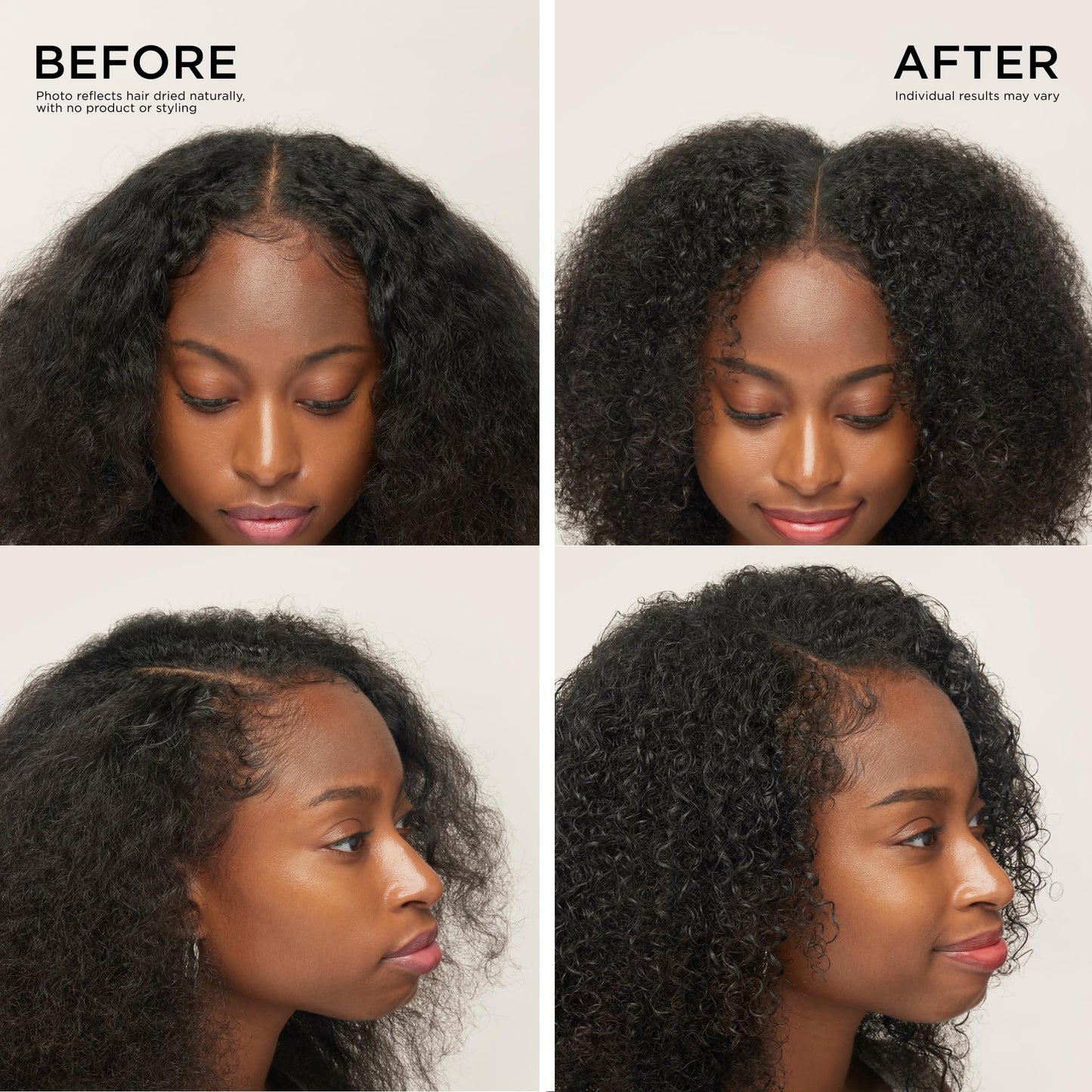 Dr. Groot Award-Winning Hair Thickening Serum for Hair Loss, Thinning Hair, Korean Hair Care, Scalp Treatment, Clinically Tested, Thicker, Reduces Oil, Roll On