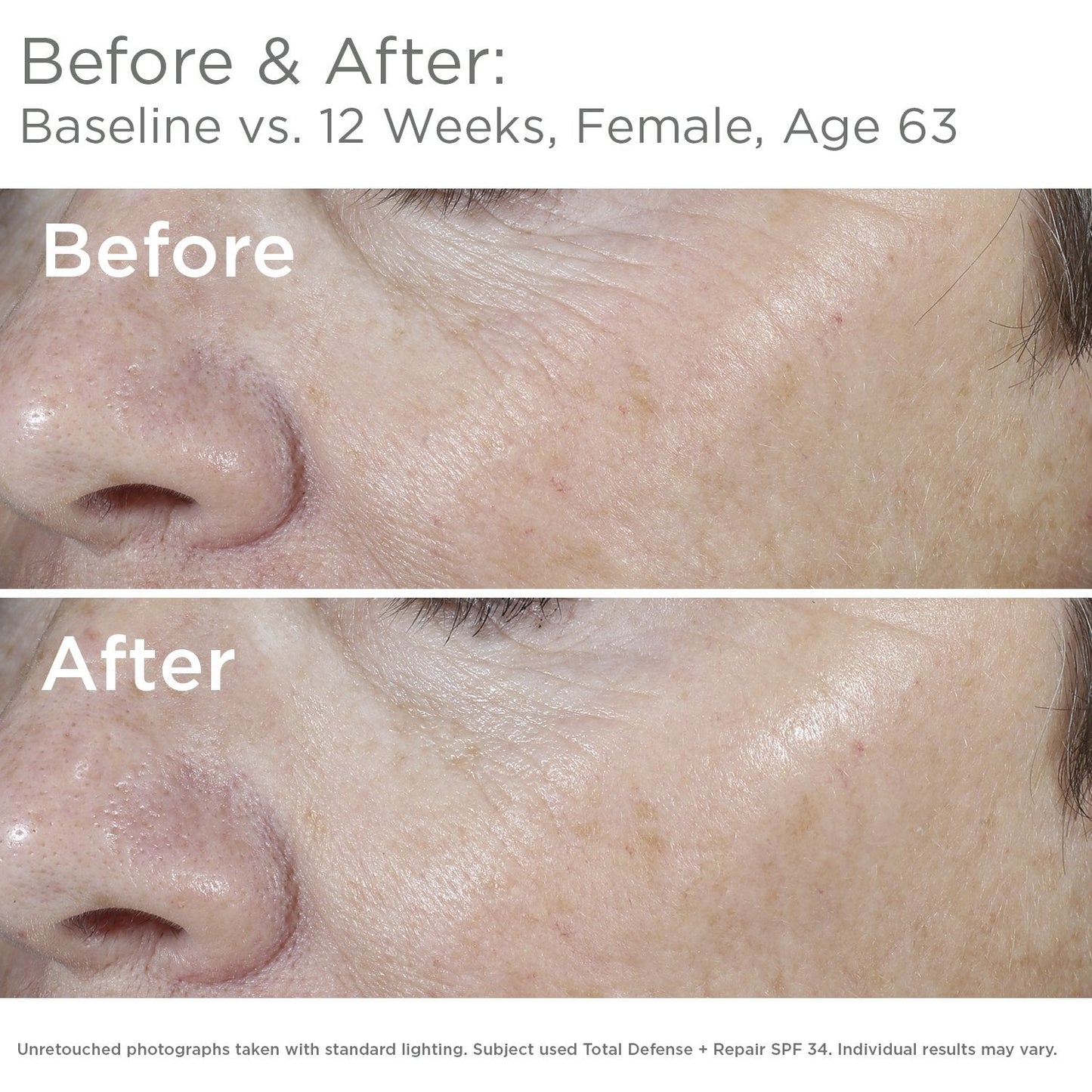 SkinMedica Total Defense + Repair SPF 34 Sunscreen for Face. This Lightweight, Facial Sunscreen is Ideal for Oily and/or Combination Skin, 2.3 Oz