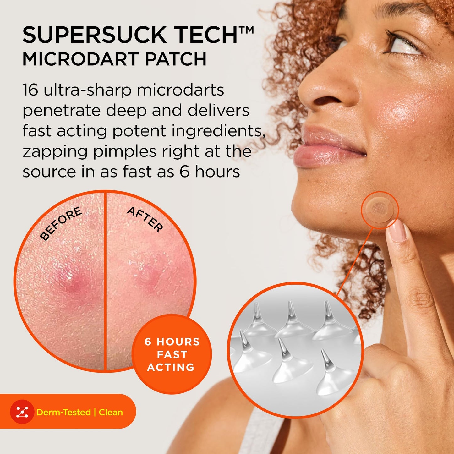 ZitSticka Killa Microdart Pimple Patches for Face - Most Potent Pimple Patch with Fast-Acting Microdarts - For Deep, Early-Stage Zits with Salicylic Acid - Mini 16 Count