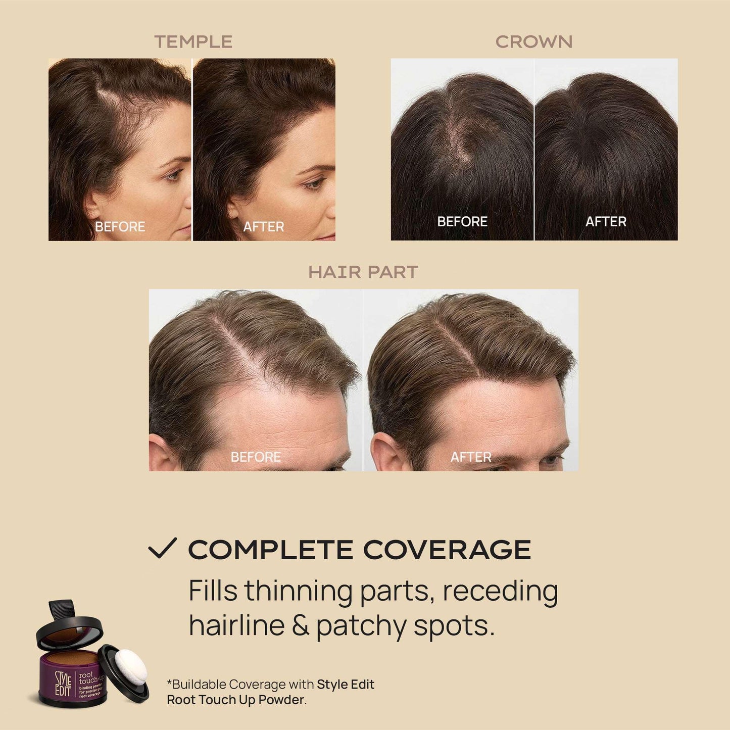 Style Edit Hair Building Fibers for Thinning Hair | Conceals Receding Hairlines, Fine Hair & Bald Spots for Fuller looking hair, 100% Plant-Based Thickening Powder for Men & Women, Medium Brown 0.88oz