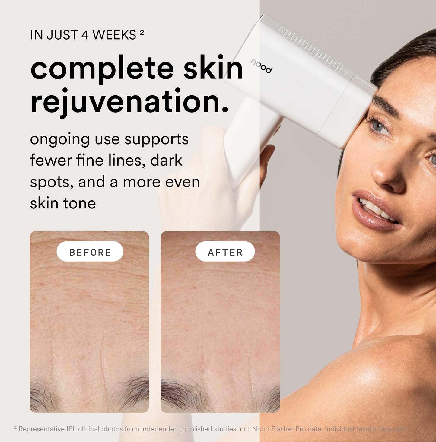 Nood™ NEW Flasher Pro — IPL Laser Hair Removal Device & Anti-Aging Red Light Therapy for Women & Men — Pain-free, Permanent, Visible Results After First Use & Works Everywhere Hair Grows — Gloss White