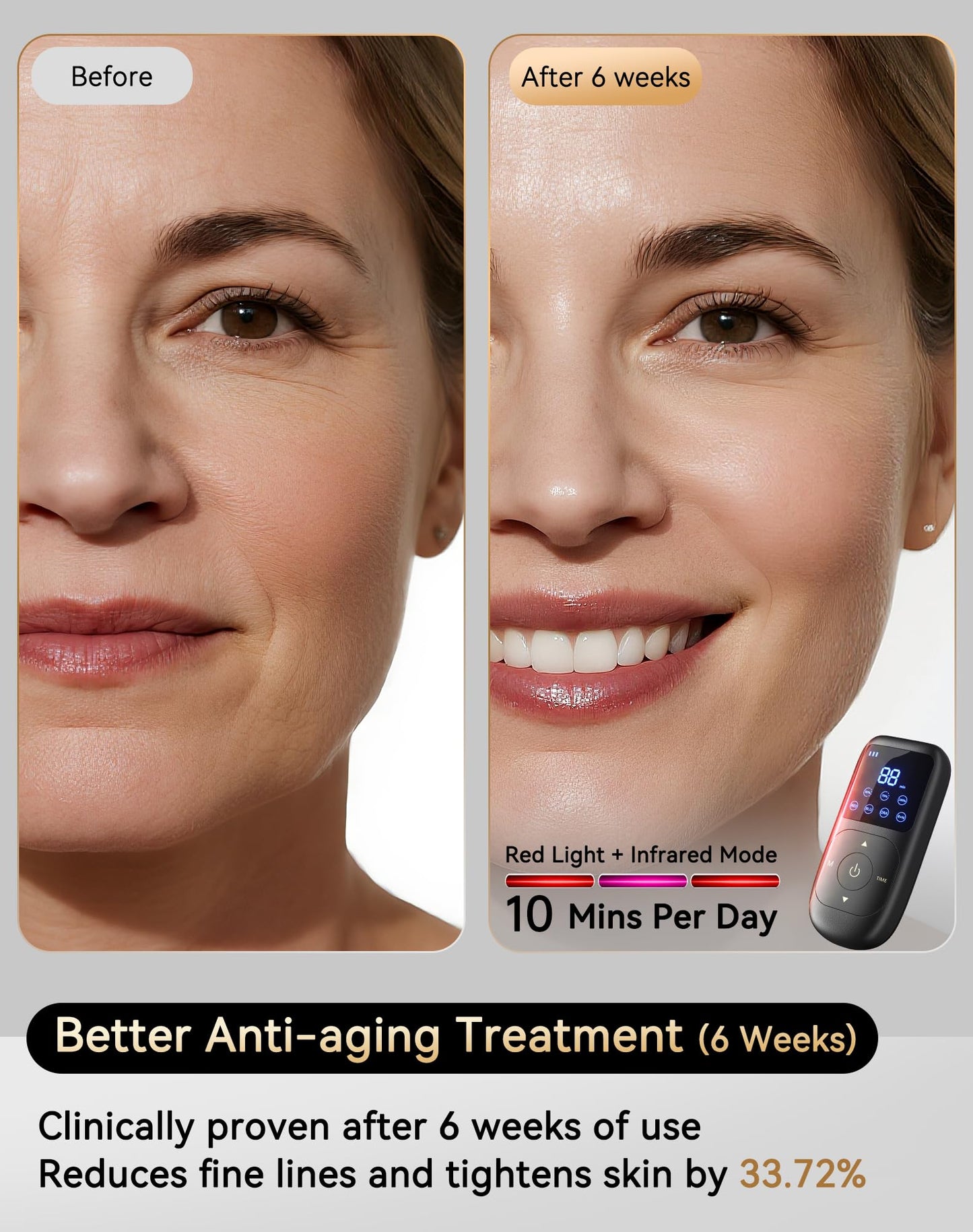 4D Red Light Therapy for Face, 4 Modes & 4000mAh Rechargeable Remote, LED Face Mask Light Therapy - Infrared & Red Light Mask, iQLED 5X Energy for Wrinkle & Acne Reduction, Timing Home & Travel