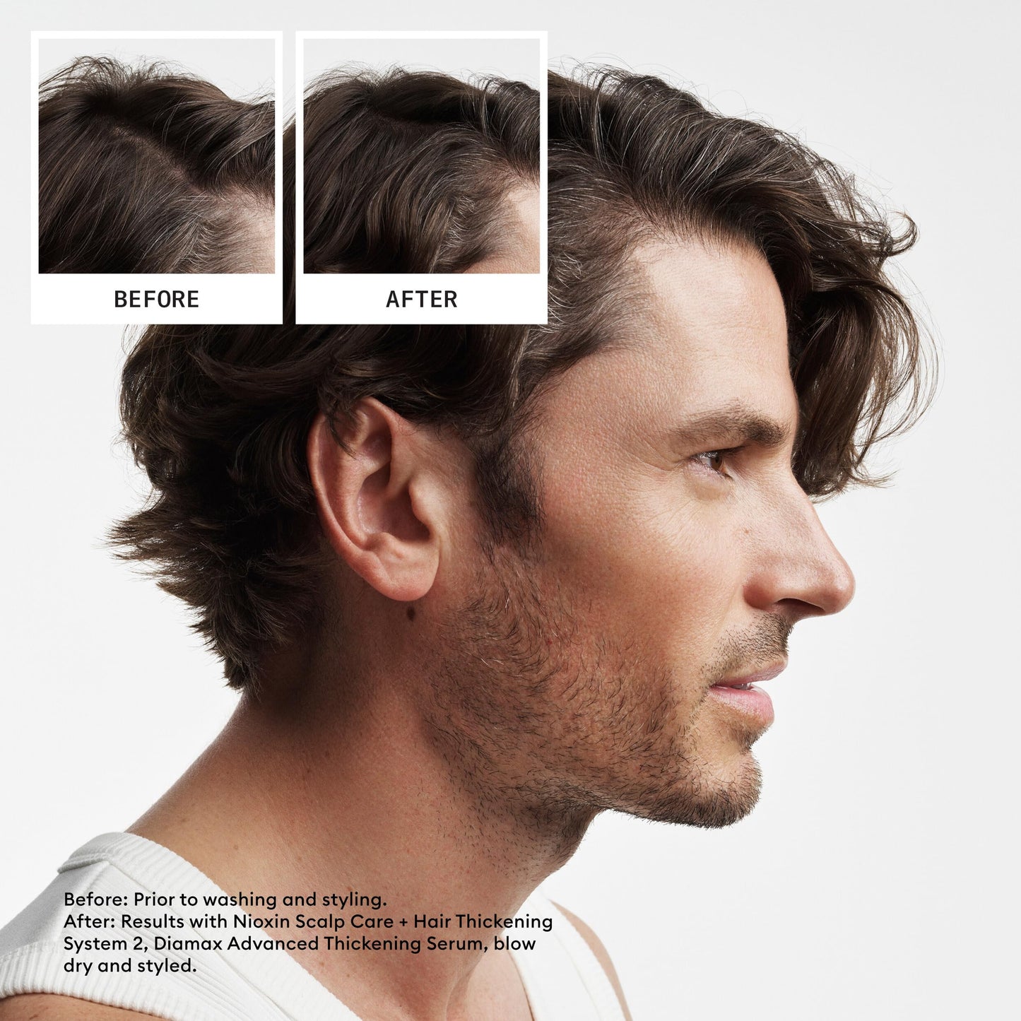Nioxin Scalp + Hair Thickening System 2 Shampoo | For Natural or Untreated Hair with Progressed Thinning | With Niacinamide and Biotin | 16.9 Fl oz.