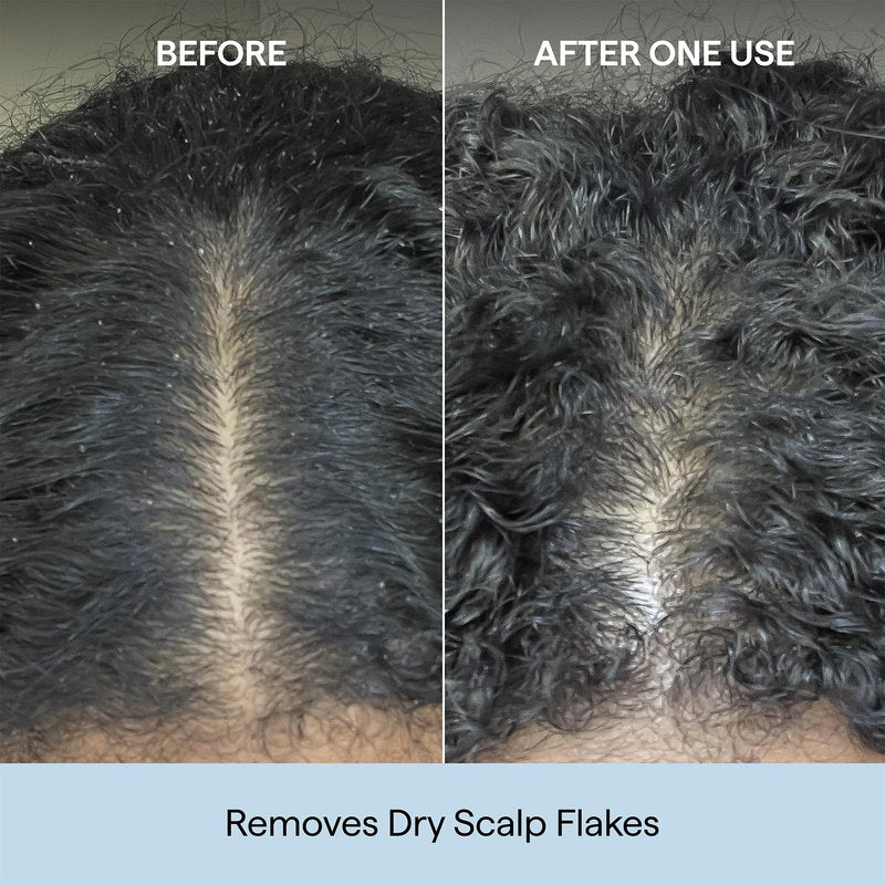 Briogeo Scalp Revival Charcoal + Coconut Oil Micro-Exfoliating Shampoo | Sulfate-Free Scalp Scrub for Dry, Itchy, or Oily Scalp | Detoxifying & Hydrating | Vegan & Cruelty Free | 8 oz